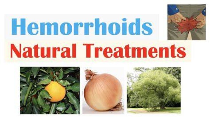 Will haemorrhoids go away?
