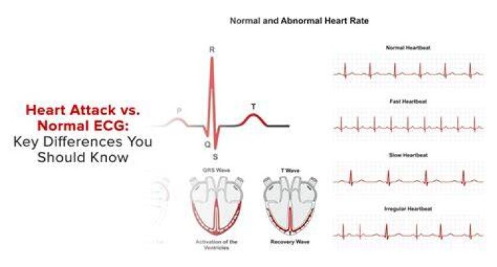 Would an ecg show heart problems?